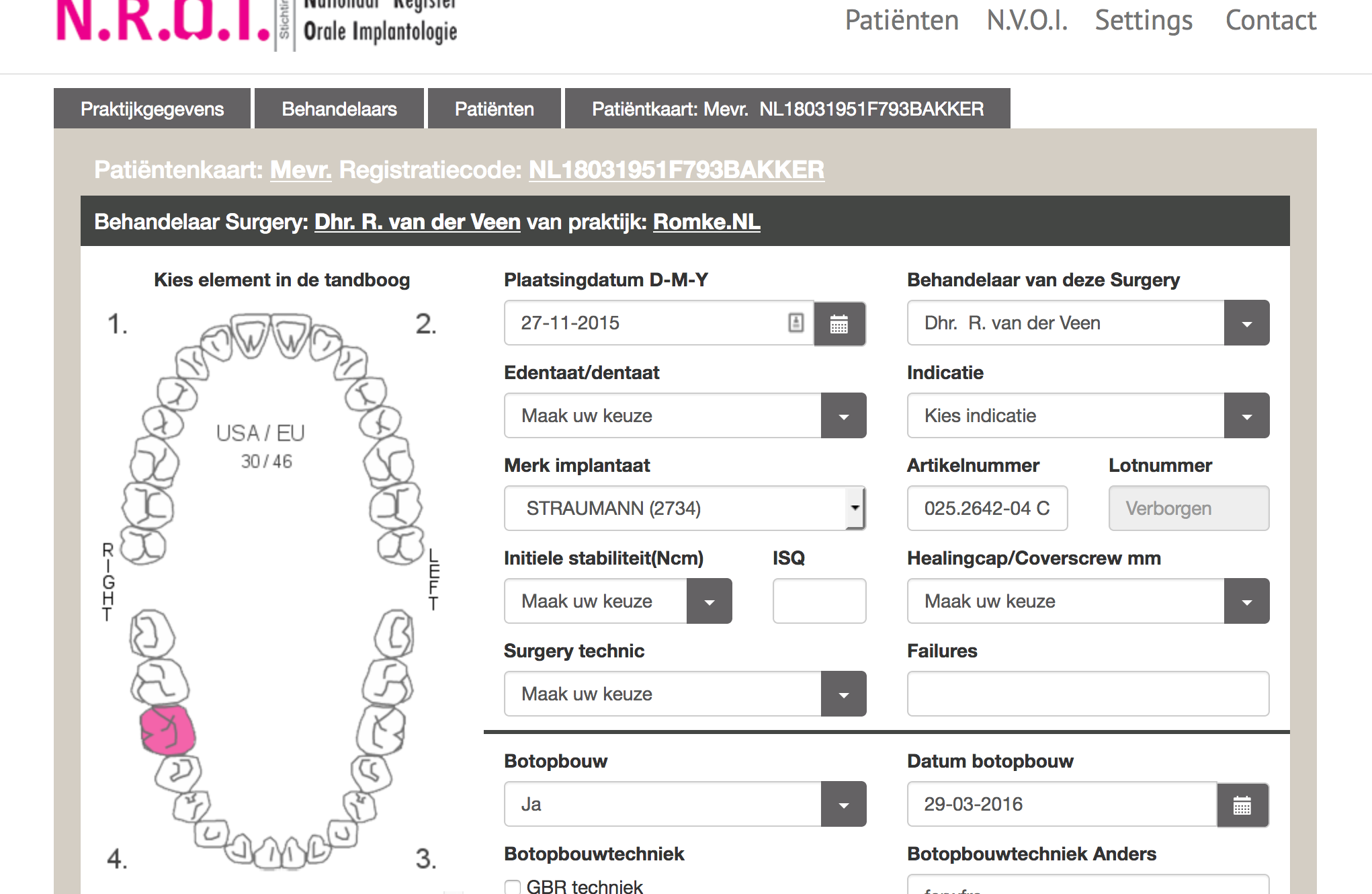 NROI: Revolutionaire Transparantie in Orale Implantologie